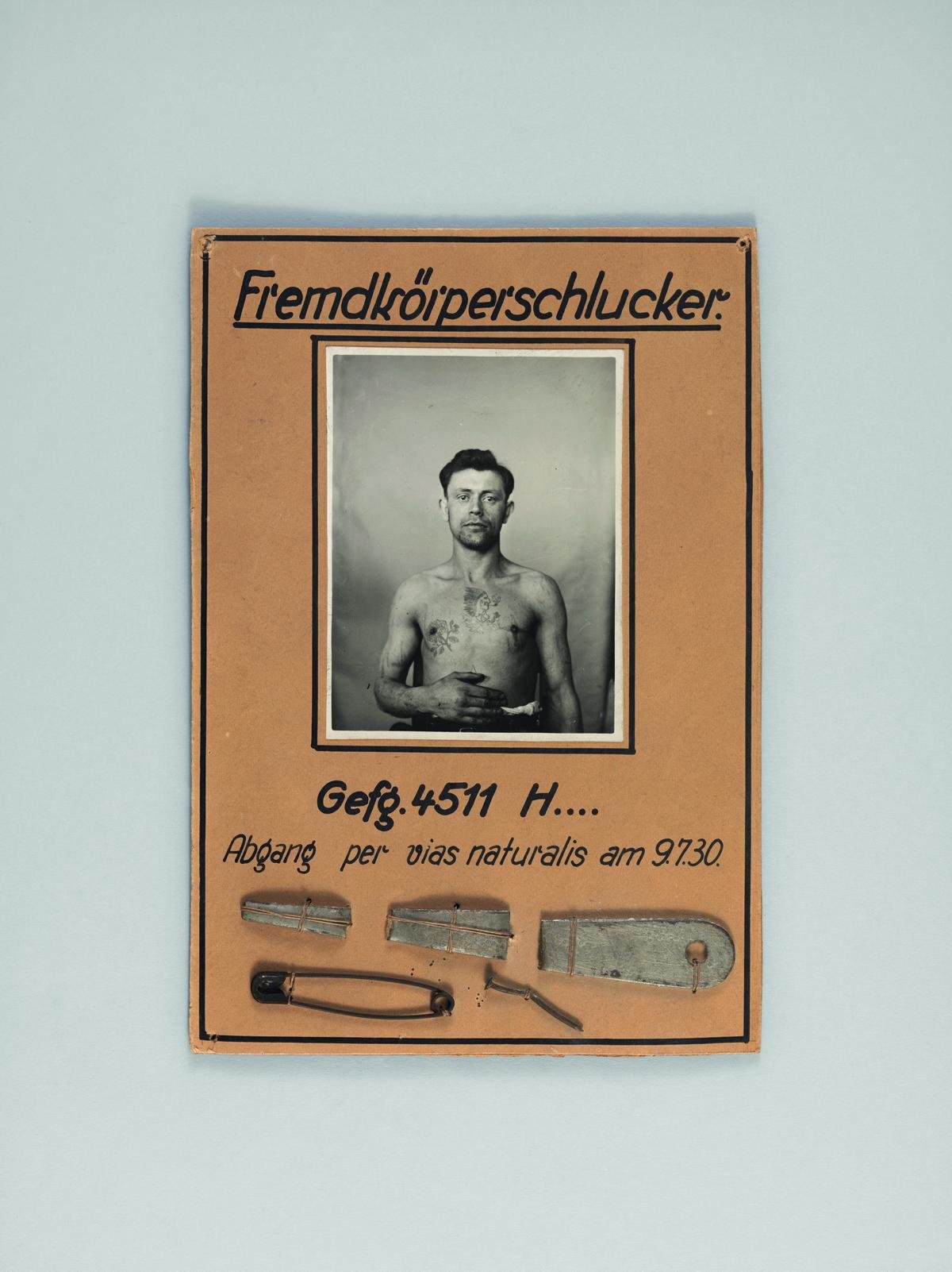Schautafel „Fremdkörperschlucker“ (Strafvollzugsmuseum Ludwigsburg CC BY-NC-SA)