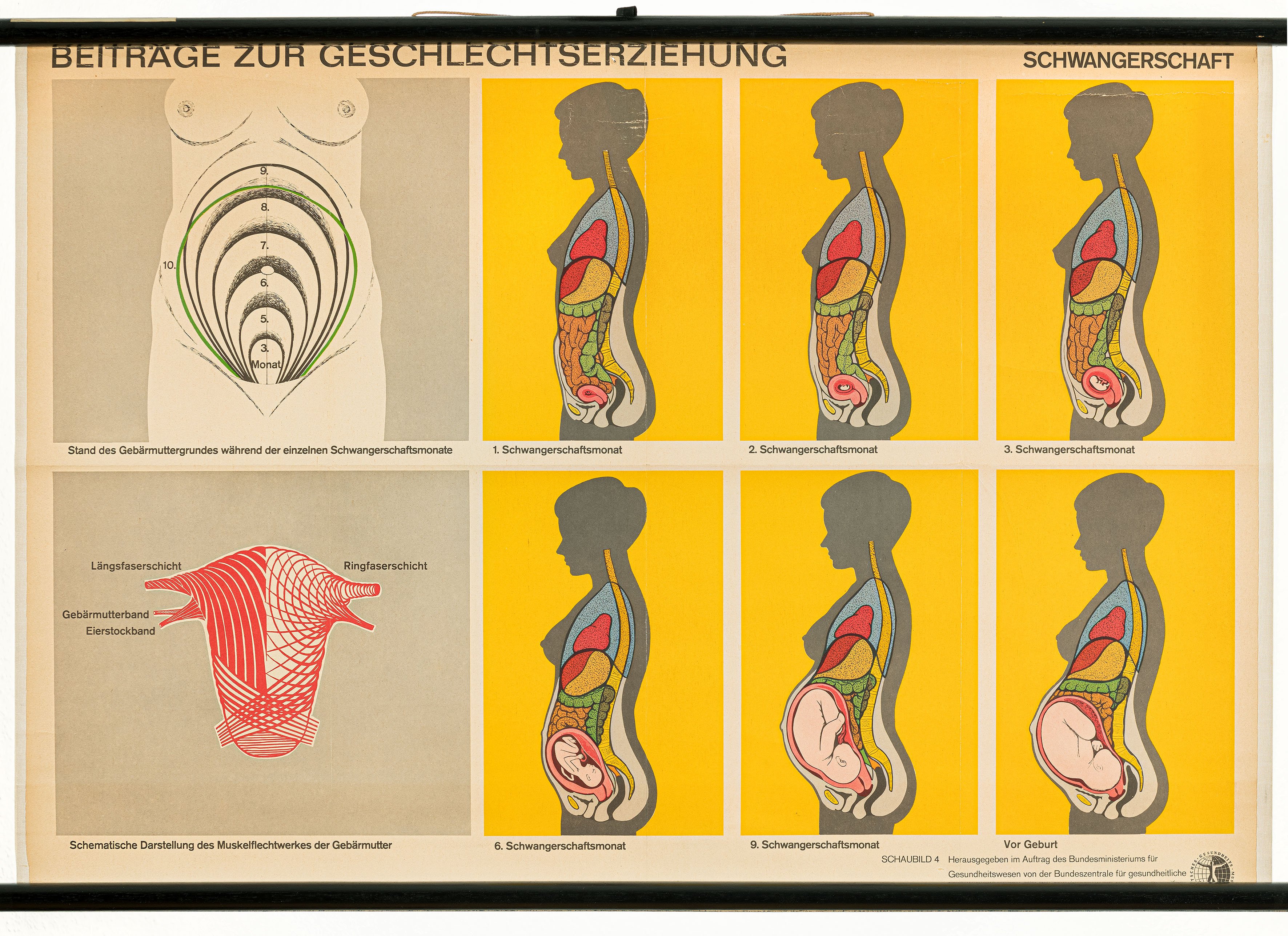 Schulwandbild "Beiträge zur Geschlechtserziehung, Schwangerschaft" (Mitte Museum/Bezirksamt Mitte von Berlin / BZgA, Köln CC0)