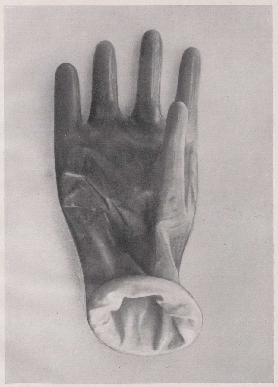 Abbildung eines Kondoms in der Form einer Hand (Magnus-Hirschfeld-Gesellschaft Public Domain Mark)