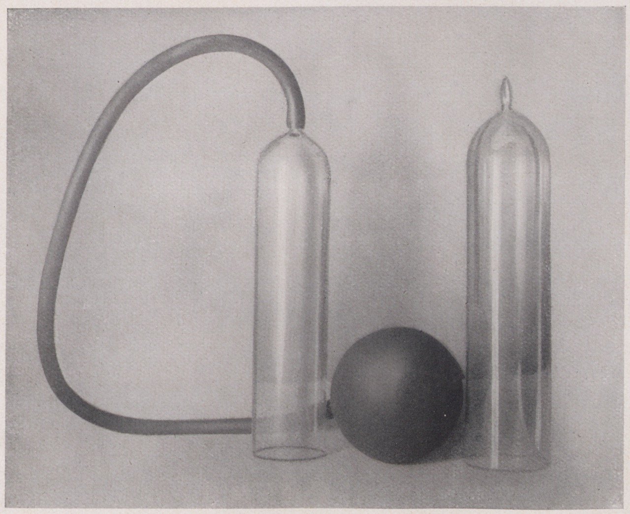 Abbildung des „Assistenten“ (Apparatur zur Behandlung von sexueller Impotenz) (Magnus-Hirschfeld-Gesellschaft Public Domain Mark)