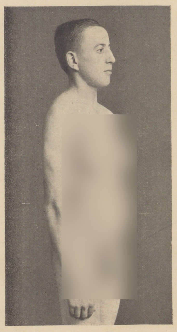 Fotografie eines 19jährigen Mannes (1) (Magnus-Hirschfeld-Gesellschaft Public Domain Mark)
