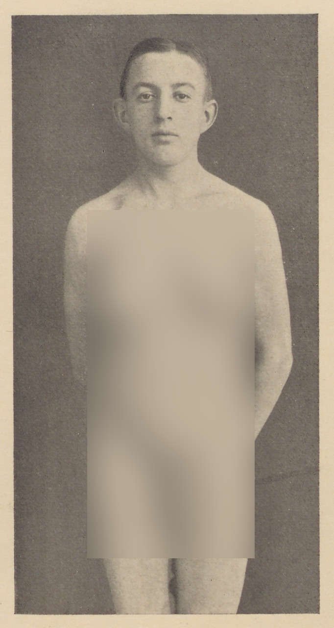 Fotografie eines 19jährigen Mannes (2) (Magnus-Hirschfeld-Gesellschaft Public Domain Mark)