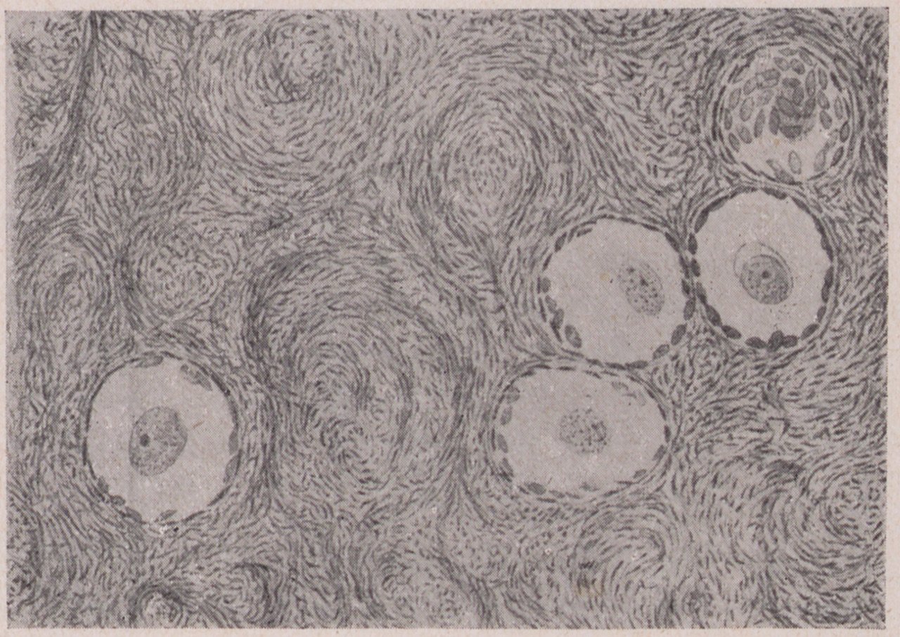 Abbildung einer mikroskopischen Aufzeichnung von Eierstockgewebe (1) (Magnus-Hirschfeld-Gesellschaft Public Domain Mark)