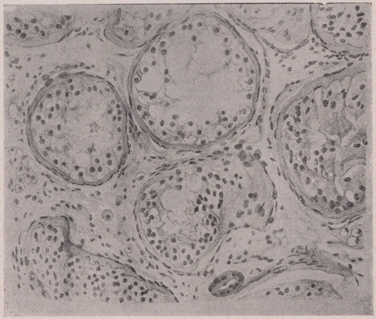 Abbildung einer mikroskopischen Aufzeichnung des Organgewebes eines Hoden (2) (Magnus-Hirschfeld-Gesellschaft Public Domain Mark)