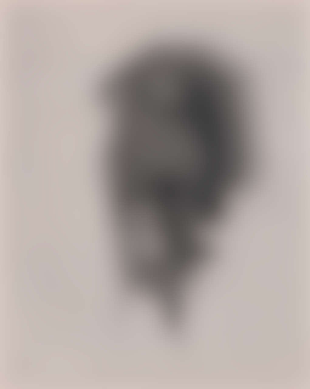 Abbildung eines Präparat eines Geschlechtsteils (von vorn) (1) (Magnus-Hirschfeld-Gesellschaft Public Domain Mark)