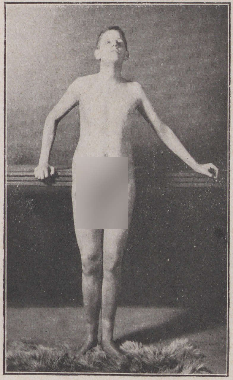 Fotografie, die den 19 jährigen P. zeigt (2) (Magnus-Hirschfeld-Gesellschaft Public Domain Mark)