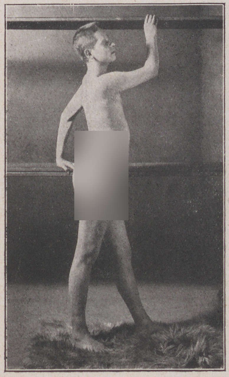 Fotografie, die den 19 jährigen P. zeigt (3) (Magnus-Hirschfeld-Gesellschaft Public Domain Mark)