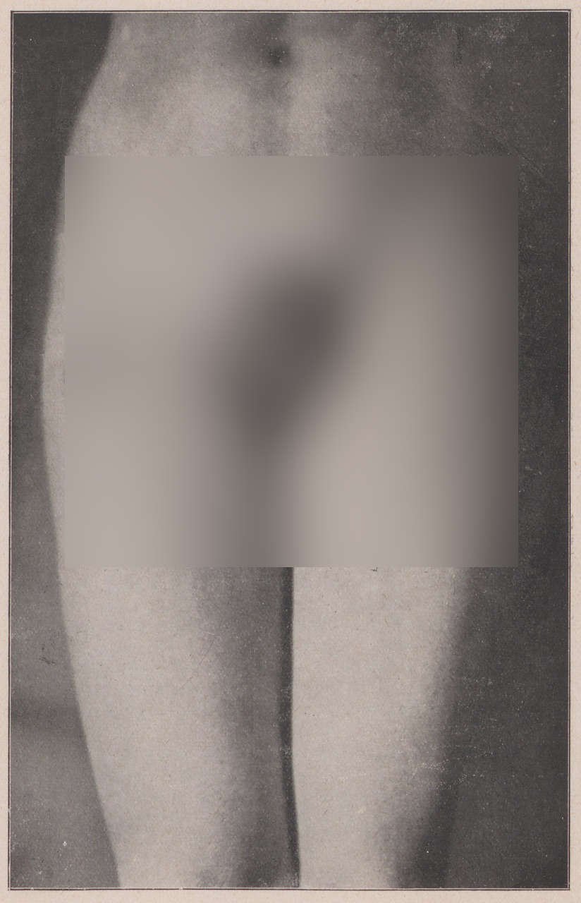 Fotografie, die den 19 jährigen P. zeigt (5) (Magnus-Hirschfeld-Gesellschaft Public Domain Mark)
