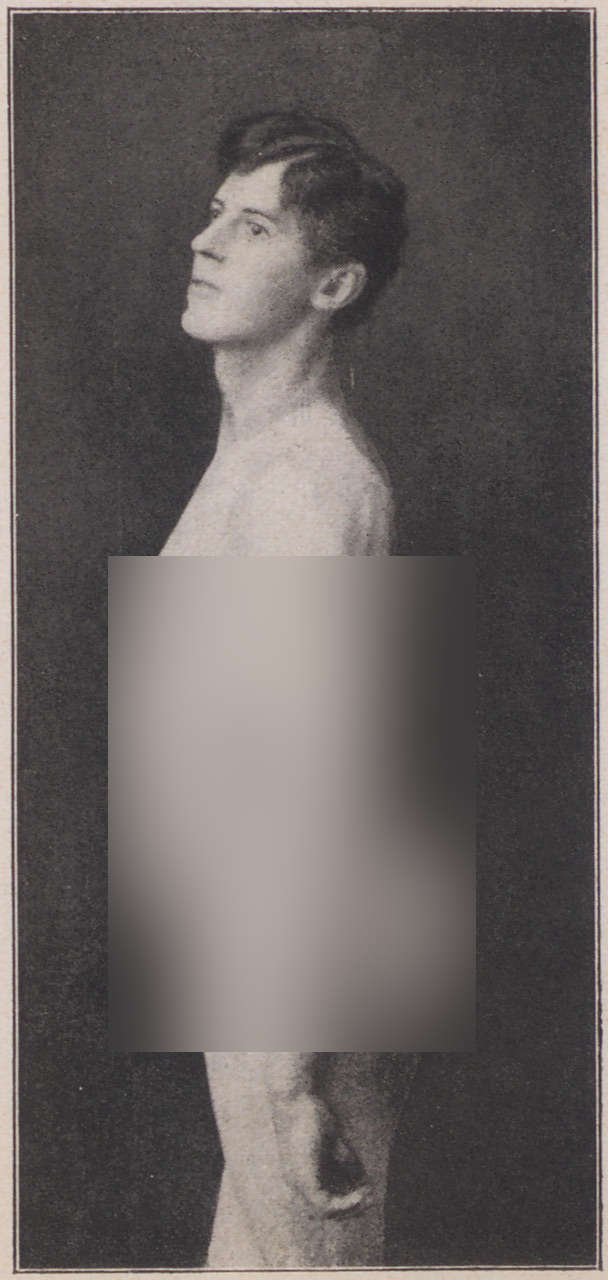 Abbildung eines stehenden unbekleideten Mannes (Magnus-Hirschfeld-Gesellschaft Public Domain Mark)