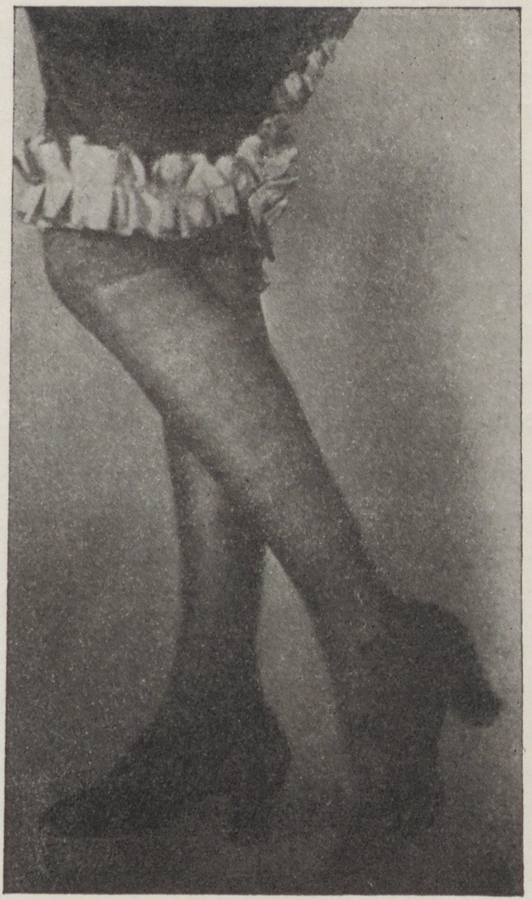 Fotografie zweier Damenbeine in Schuhen (Magnus-Hirschfeld-Gesellschaft Public Domain Mark)
