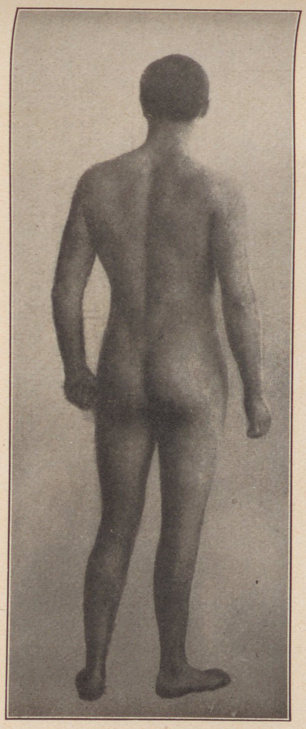Fotografie eines unbekleideten Manns (Rückenansicht) (Magnus-Hirschfeld-Gesellschaft Public Domain Mark)
