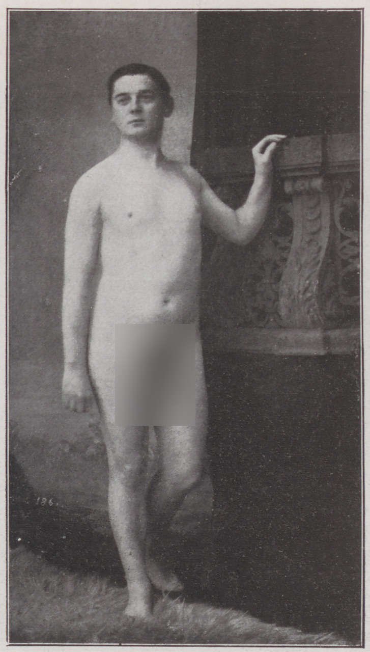 Abbildung eines unbekleideten Mannes von vorn (Magnus-Hirschfeld-Gesellschaft Public Domain Mark)