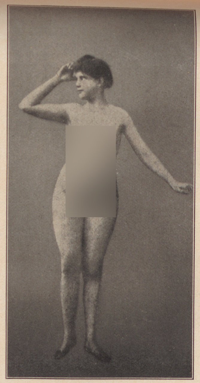 Fotografie einer unbekleideten Frau von vorn (Magnus-Hirschfeld-Gesellschaft Public Domain Mark)