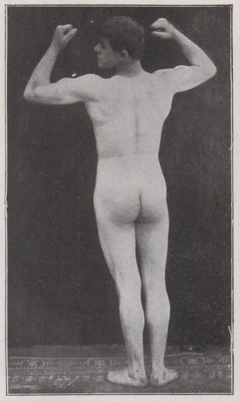 Abbildung eines unbekleideten Mannes (Rückenansicht) (Magnus-Hirschfeld-Gesellschaft Public Domain Mark)