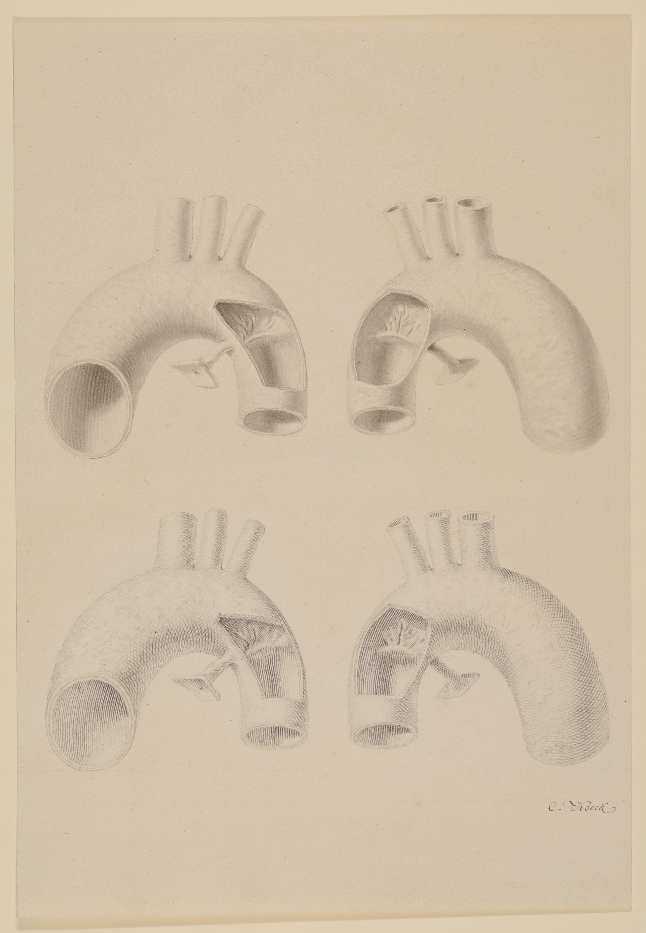 Prüfen [aus einem Konvolut anatomischer Zeichnungen des Christian Koeck] (Freies Deutsches Hochstift CC BY-NC-SA)