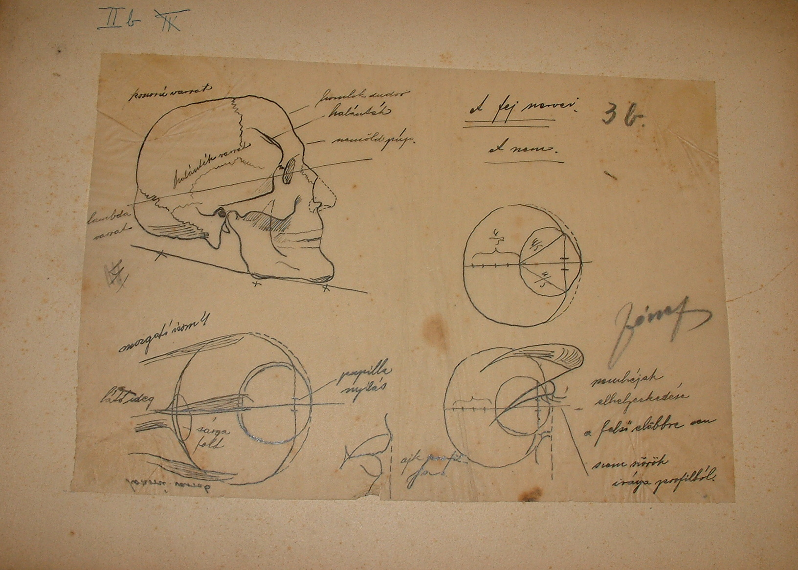 Anatómaiai sorozat II/b. (Erkel Ferenc Múzeum CC BY-NC-SA)