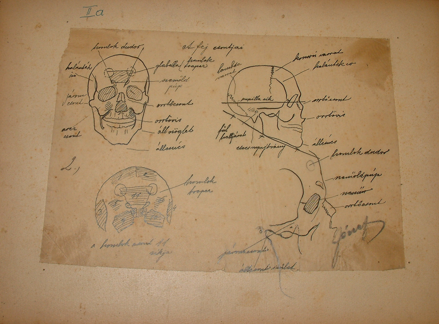 Anatómiai sorozat II/a. (Erkel Ferenc Múzeum CC BY-NC-SA)