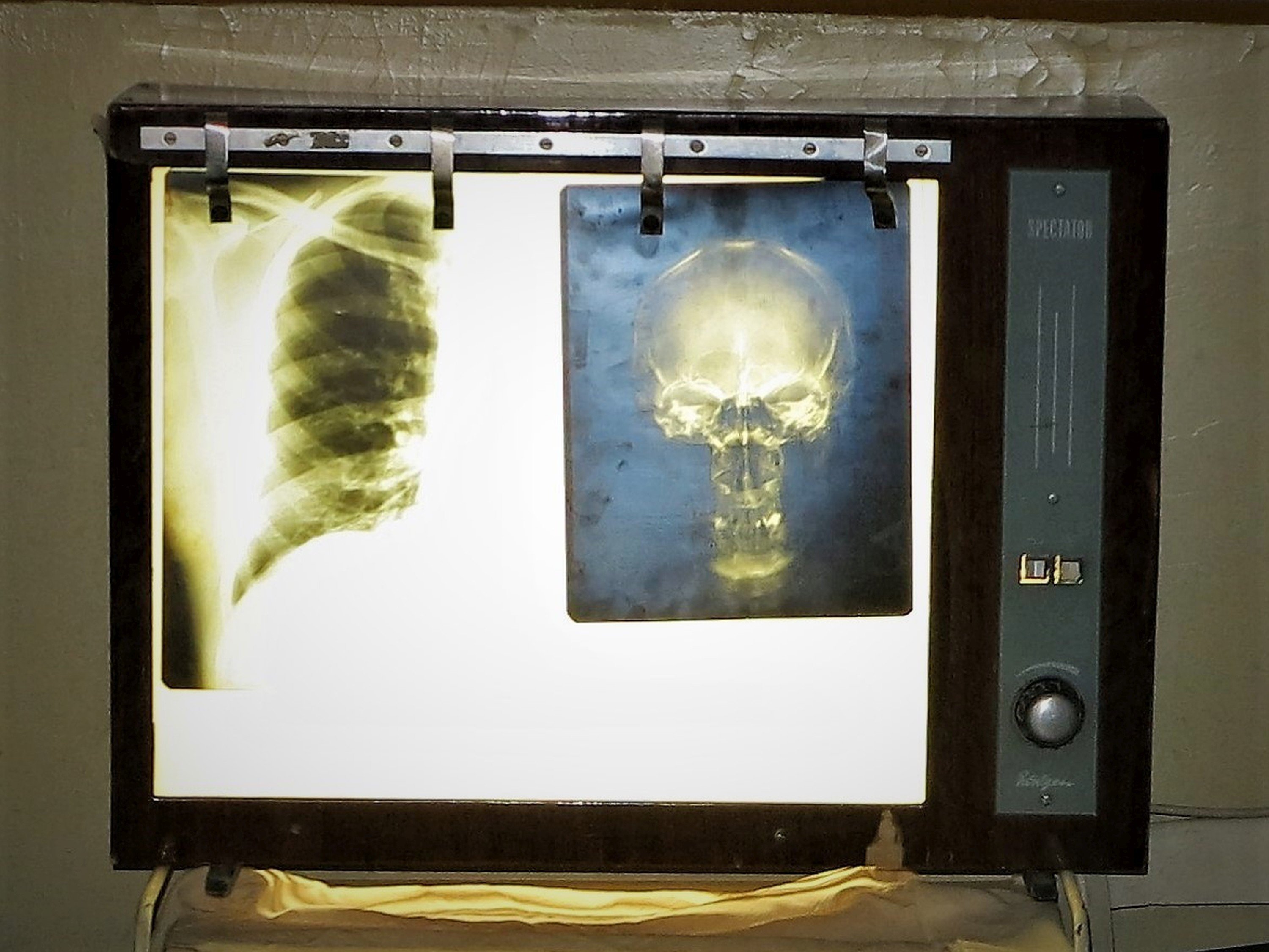 Röntgenfilm néző (Sziklakórház Atombunker Múzeum CC BY-NC-SA)