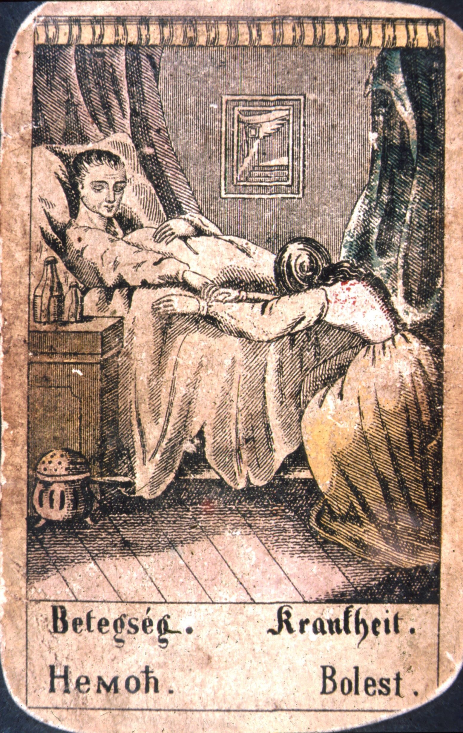 Cigány vetőkártya. 18.Betegség (Rippl-Rónai Múzeum CC BY-NC-ND)