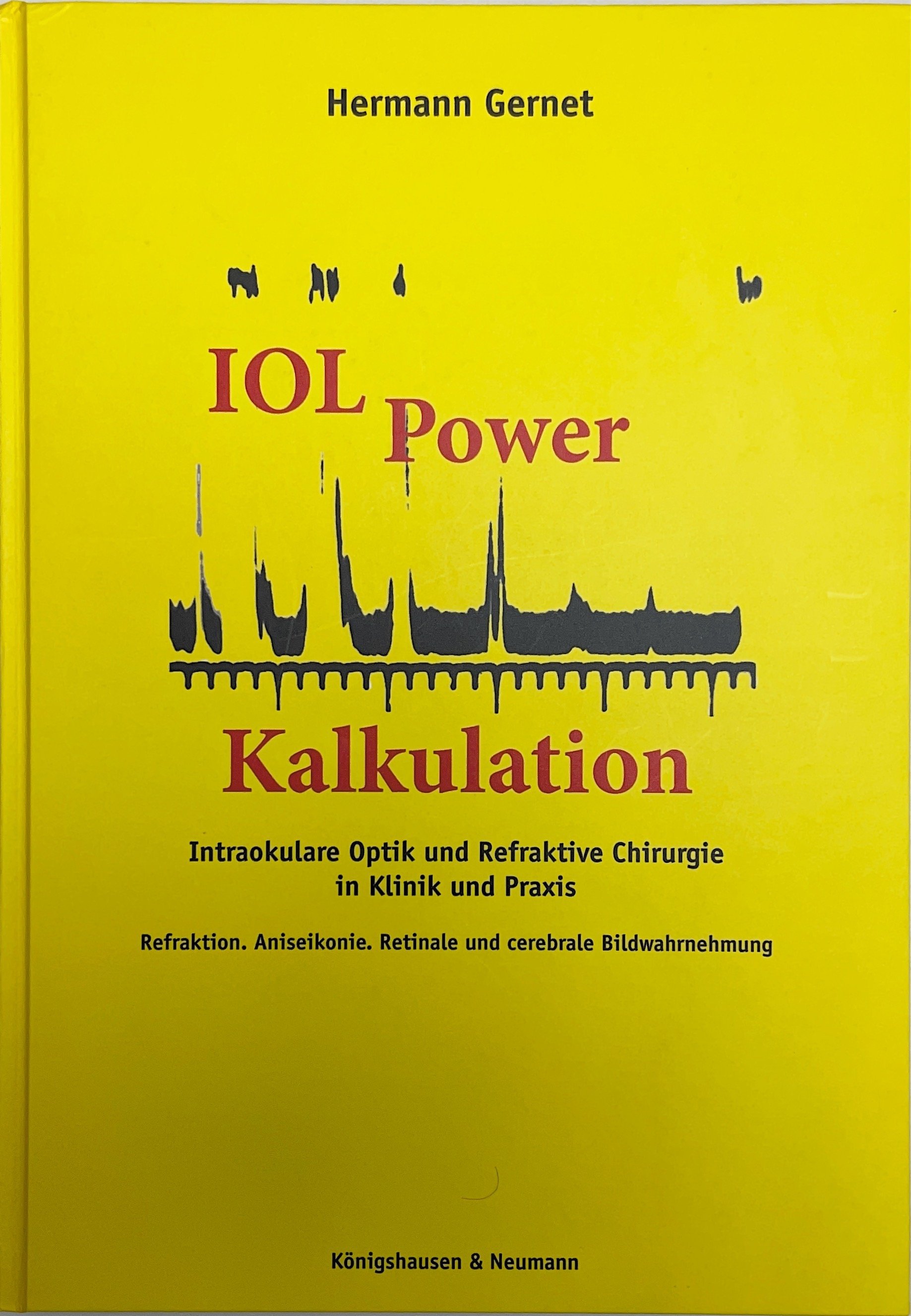 Neue IOL Power Kalkulation, Intraokulare Optik und Refraktive Chirurgie in Klink und Praxis (Krankenhausmuseum Bielefeld e.V. CC BY-NC-SA)