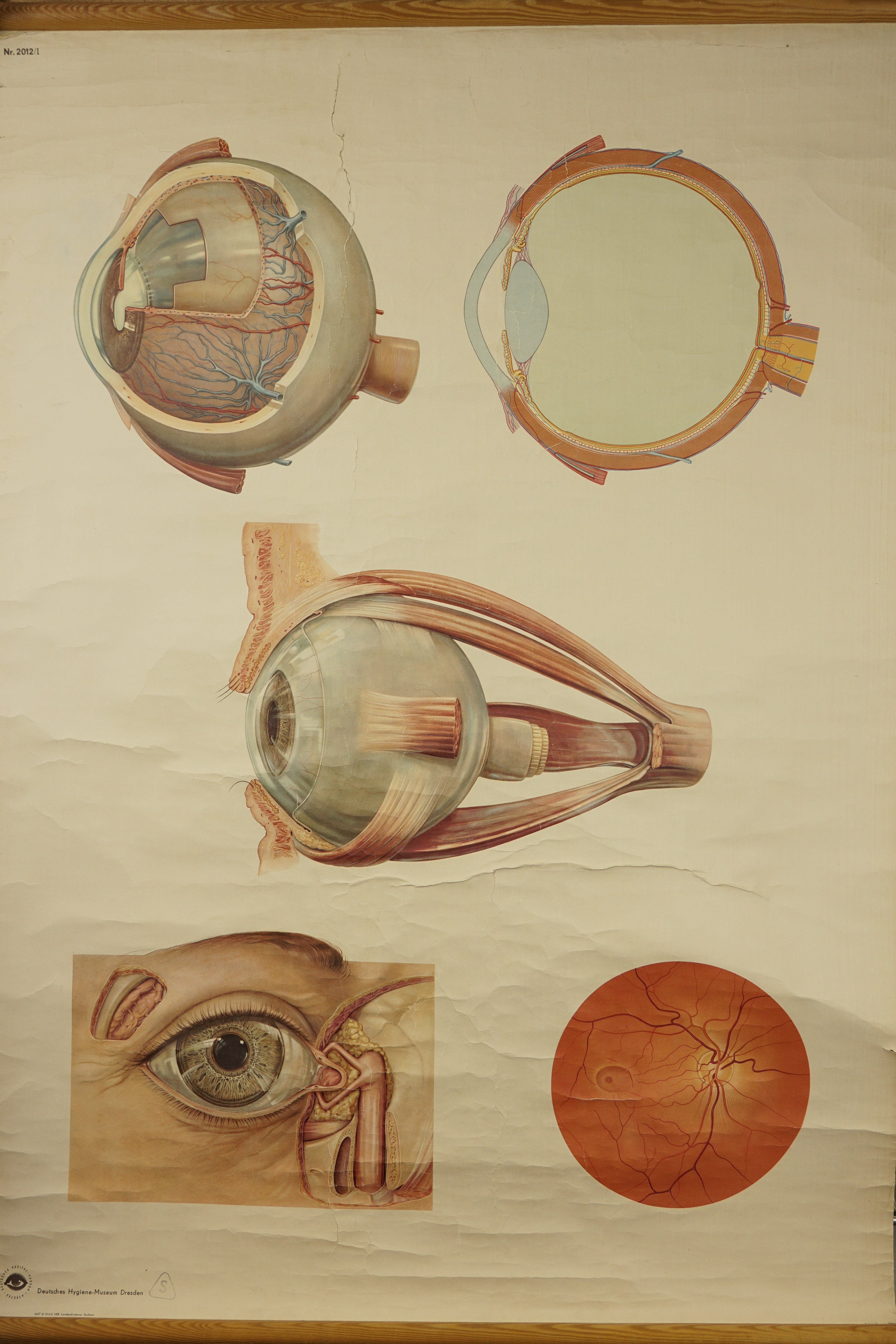 [Auge und Augenhintergrund] (Krankenhausmuseum Bielefeld e.V. CC BY-NC-SA)