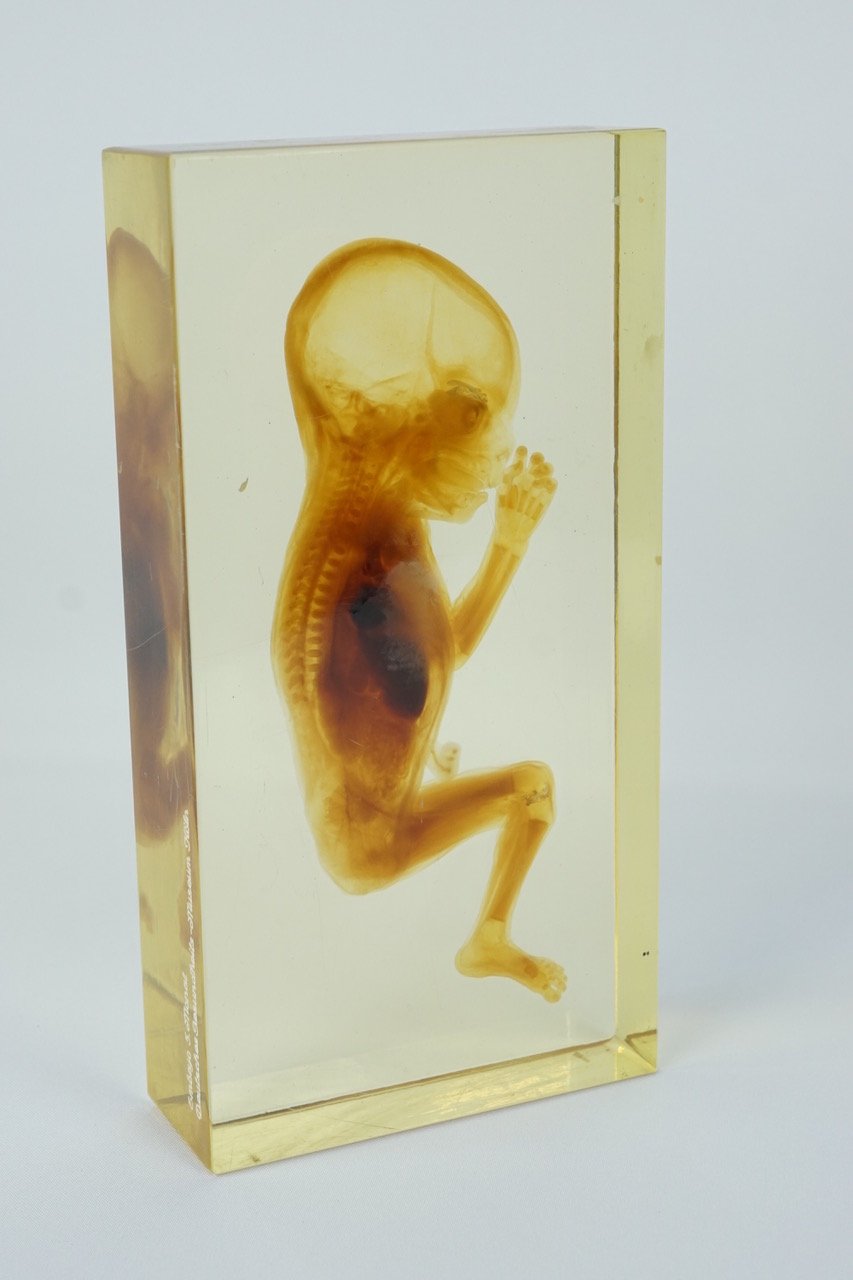 Präparierter Fetus in Epoxydharz (Krankenhausmuseum Bielefeld e.V. CC BY-NC-SA)