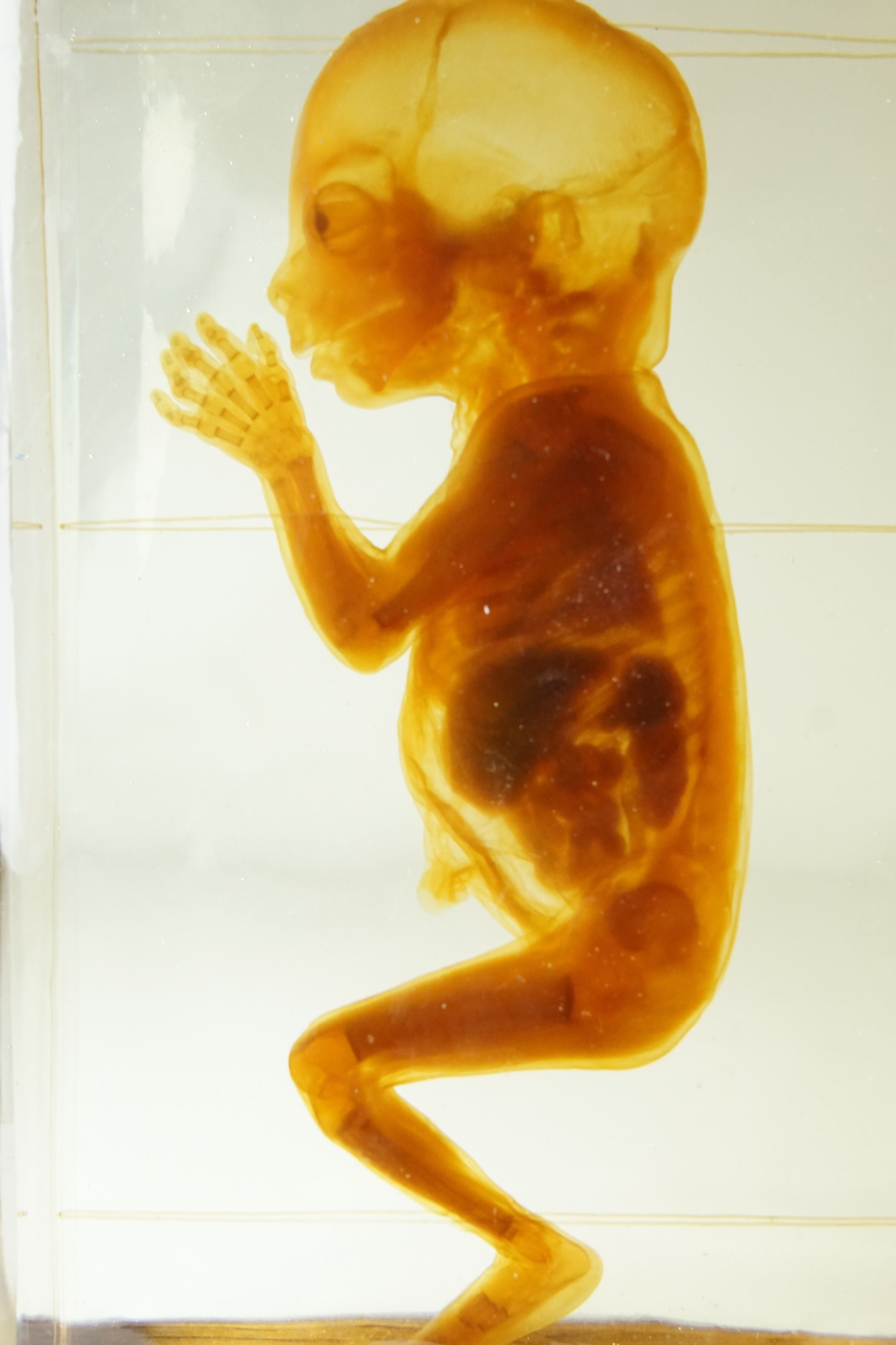Präparierter Embryo als Feuchtpräparat (Krankenhausmuseum Bielefeld e.V. CC BY-NC-SA)