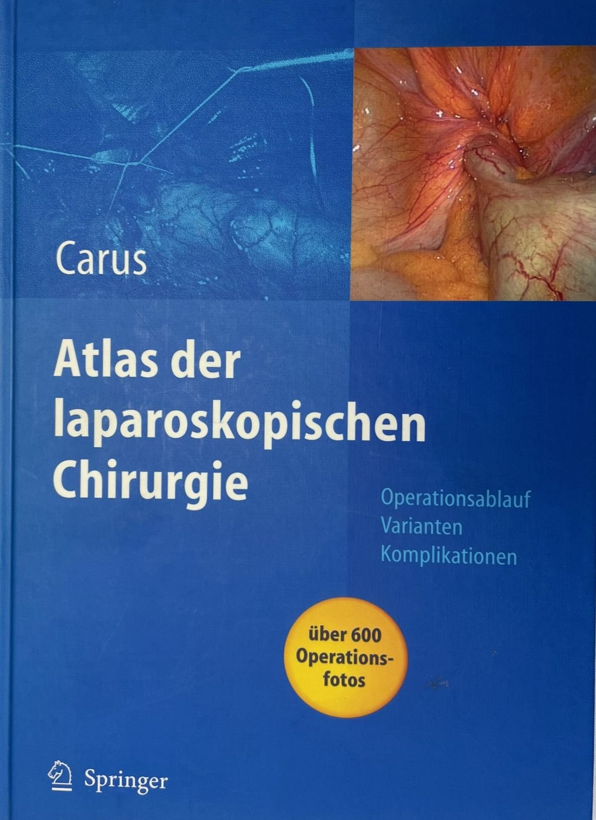 Atlas der laparoskopischen Chirurgie (Krankenhausmuseum Bielefeld e.V. CC BY-NC-SA)