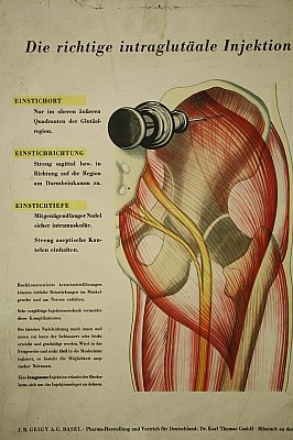 Lehrtafel: Intramuskuläre Injektion (Krankenhausmuseum Bielefeld e.V. CC BY-NC-SA)