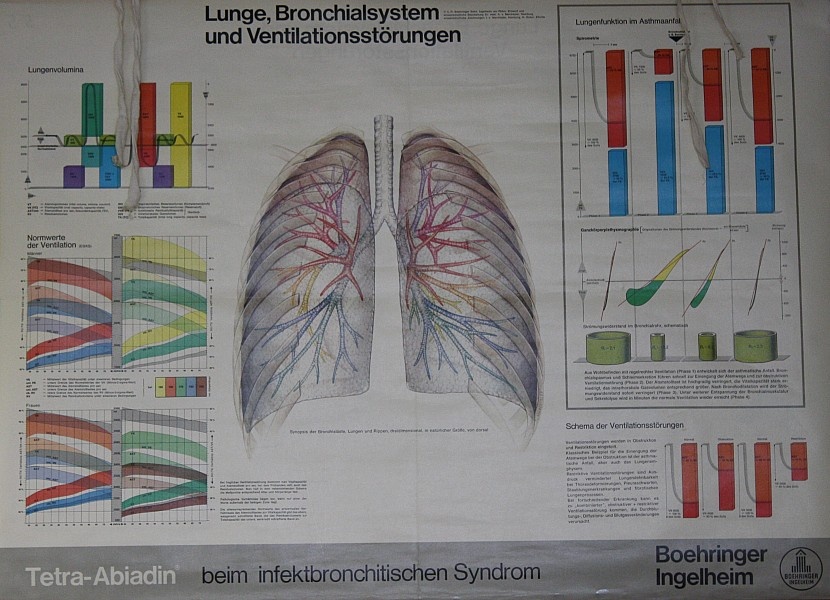 Lehrtafel Lunge und Bronchialsystem (Krankenhausmuseum Bielefeld e.V. CC BY-NC-SA)
