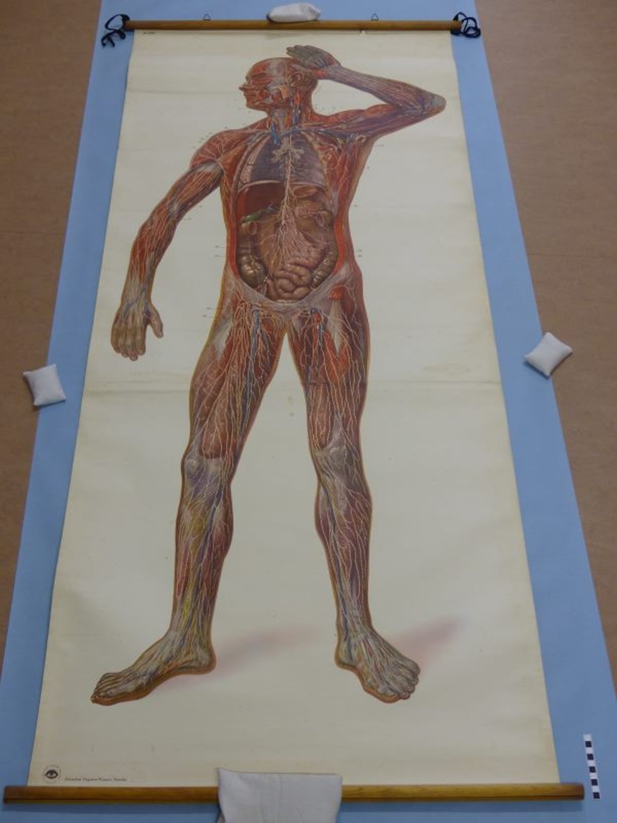 Lymphgefäße des menschlichen Körpers (Mindener Museum CC BY-NC-SA)
