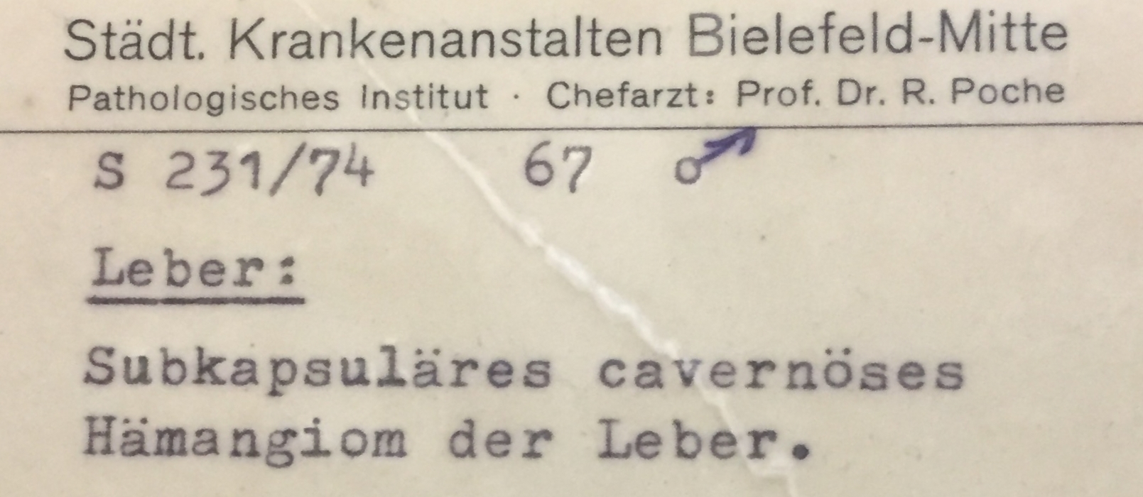 Leber: subkapsuläres cavernöses Hämangiom (Krankenhausmuseum Bielefeld e.V. CC BY-NC-SA)
