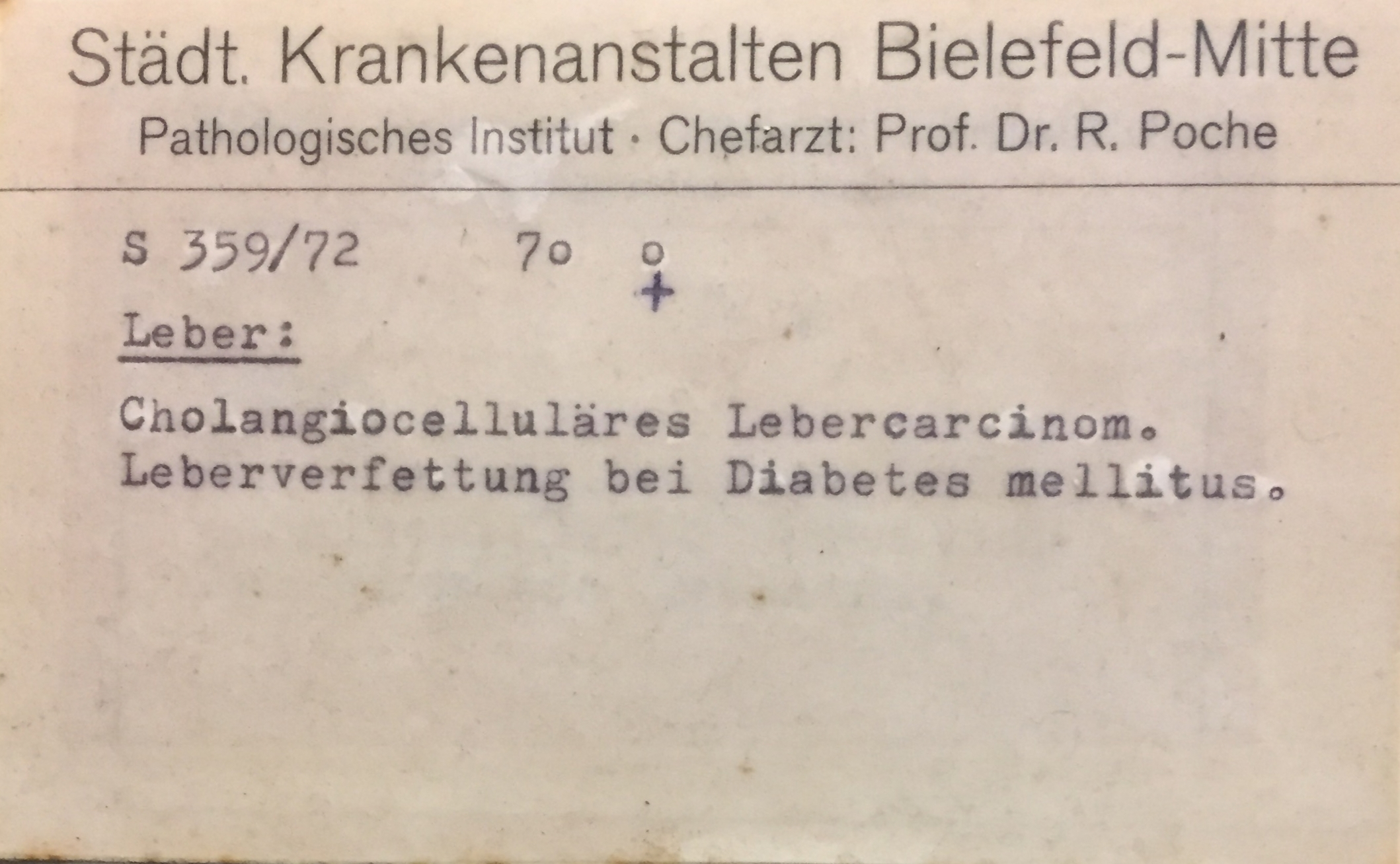 Leber-Karzinom bei Verfettung und Diabetes mellitus (Krankenhausmuseum Bielefeld CC BY-NC-SA)
