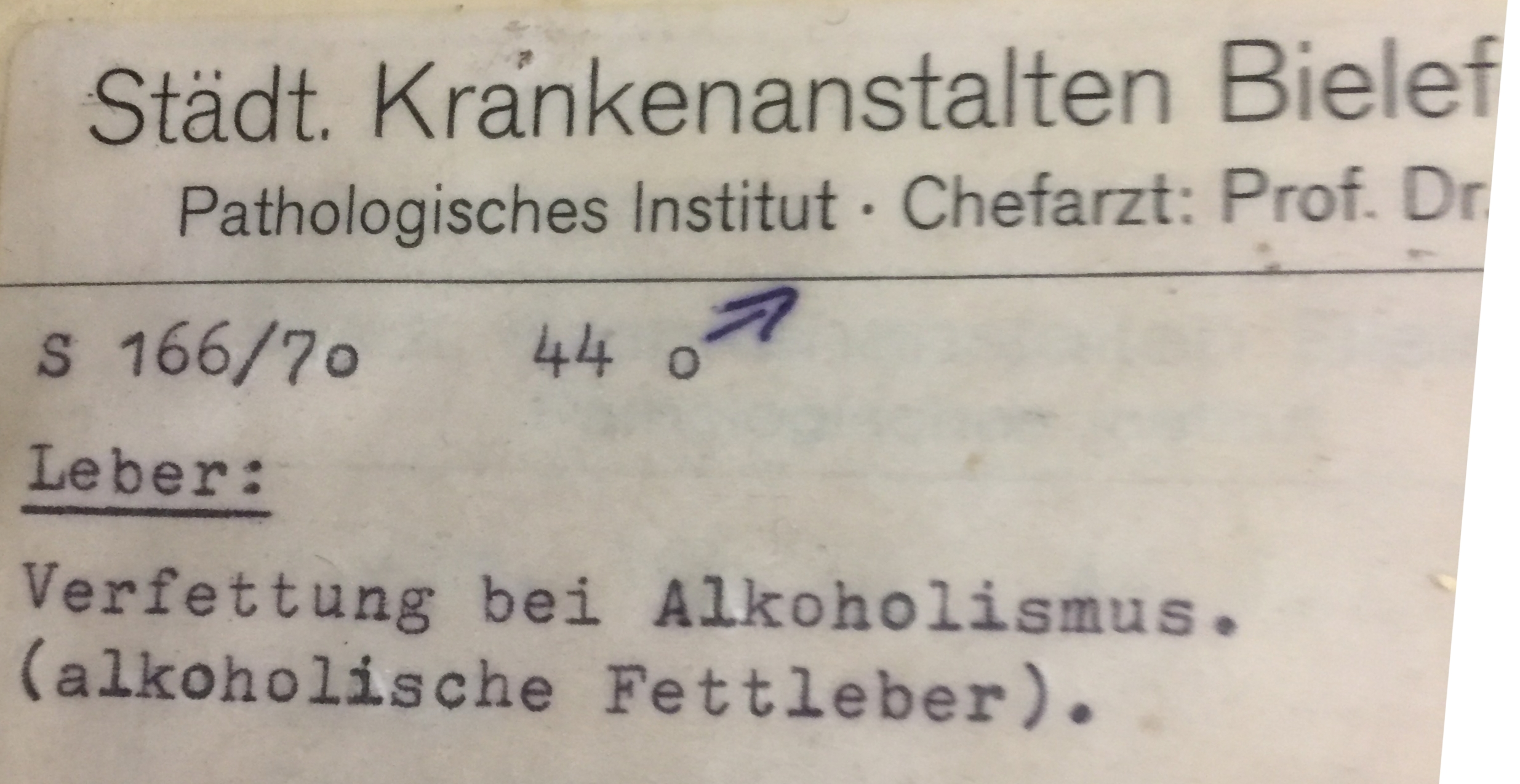 Alkoholische Fettleber (Krankenhausmuseum Bielefeld CC BY-NC-SA)