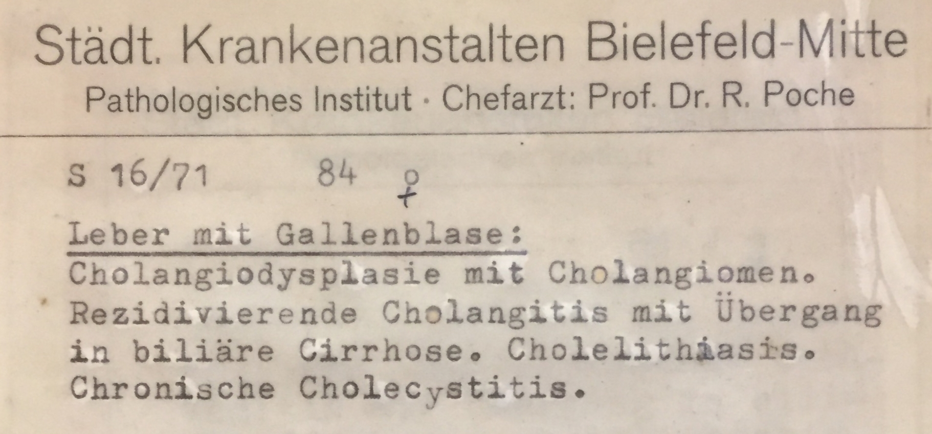 Leber mit Gallenblase: Cholangiome, Cholelithiasis, Cholezystitis (Krankenhausmuseum Bielefeld CC BY-NC-SA)