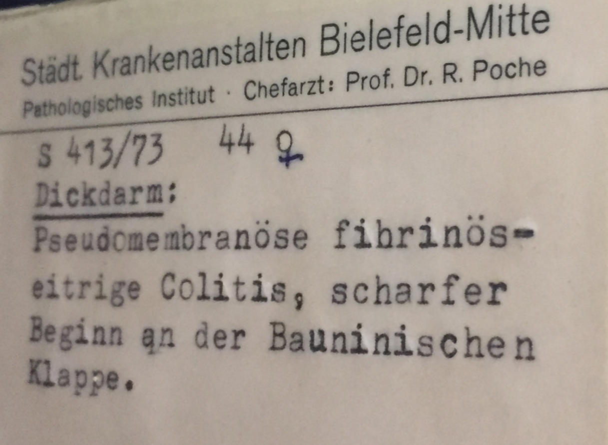 Dickdarm: Eitrige Colitis ab Bauhin-Klappe (Krankenhausmuseum Bielefeld CC BY-NC-SA)