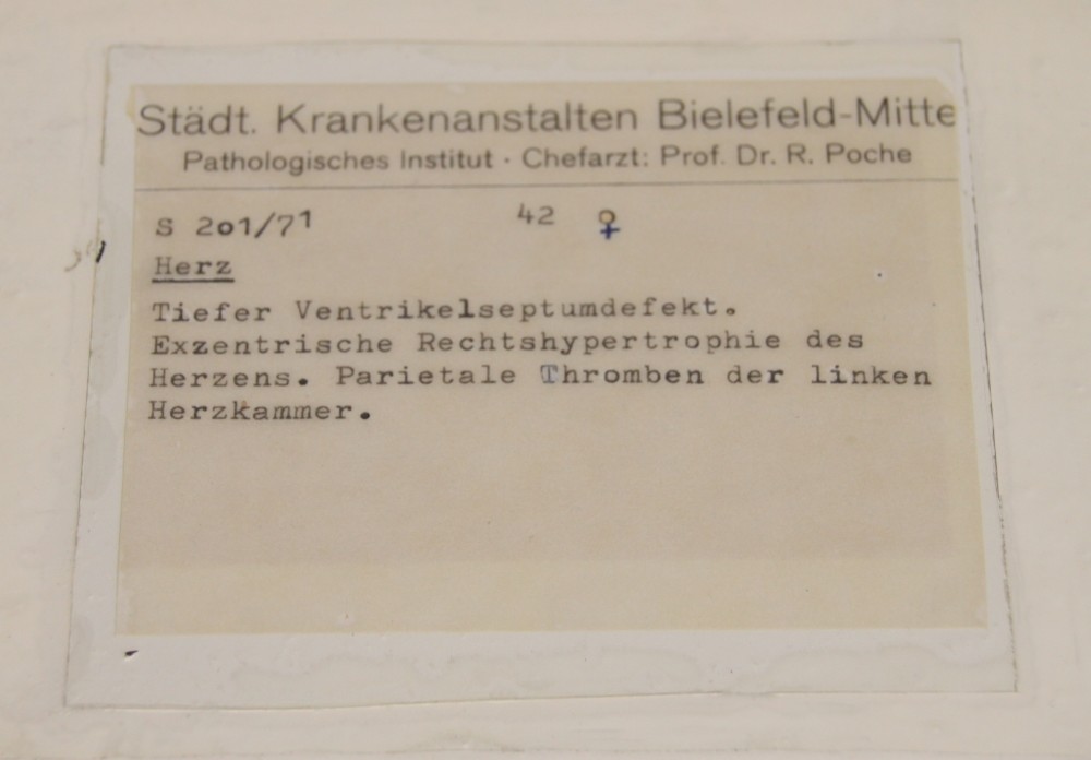 Herz-Präparat mit Ventrikelseptum-Defekt, Aufschrift (Krankenhausmuseum Bielefeld e.V. CC BY-NC-SA)