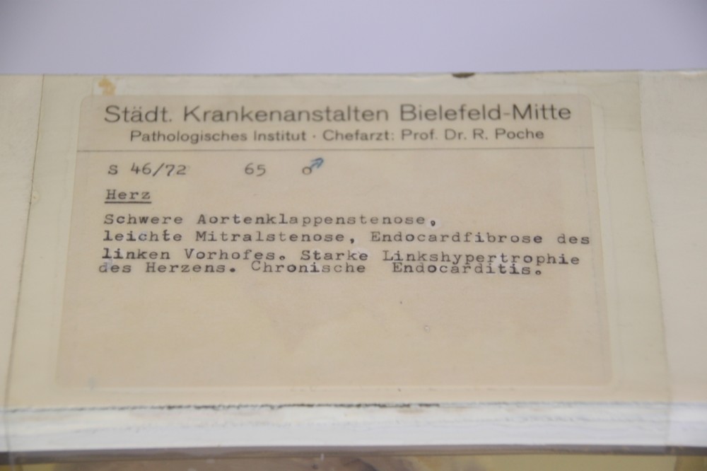 Herz-Präparat (Ventilebene) mit Aortenklappenstenose, Aufschrift (Krankenhausmuseum Bielefeld e.V. CC BY-NC-SA)