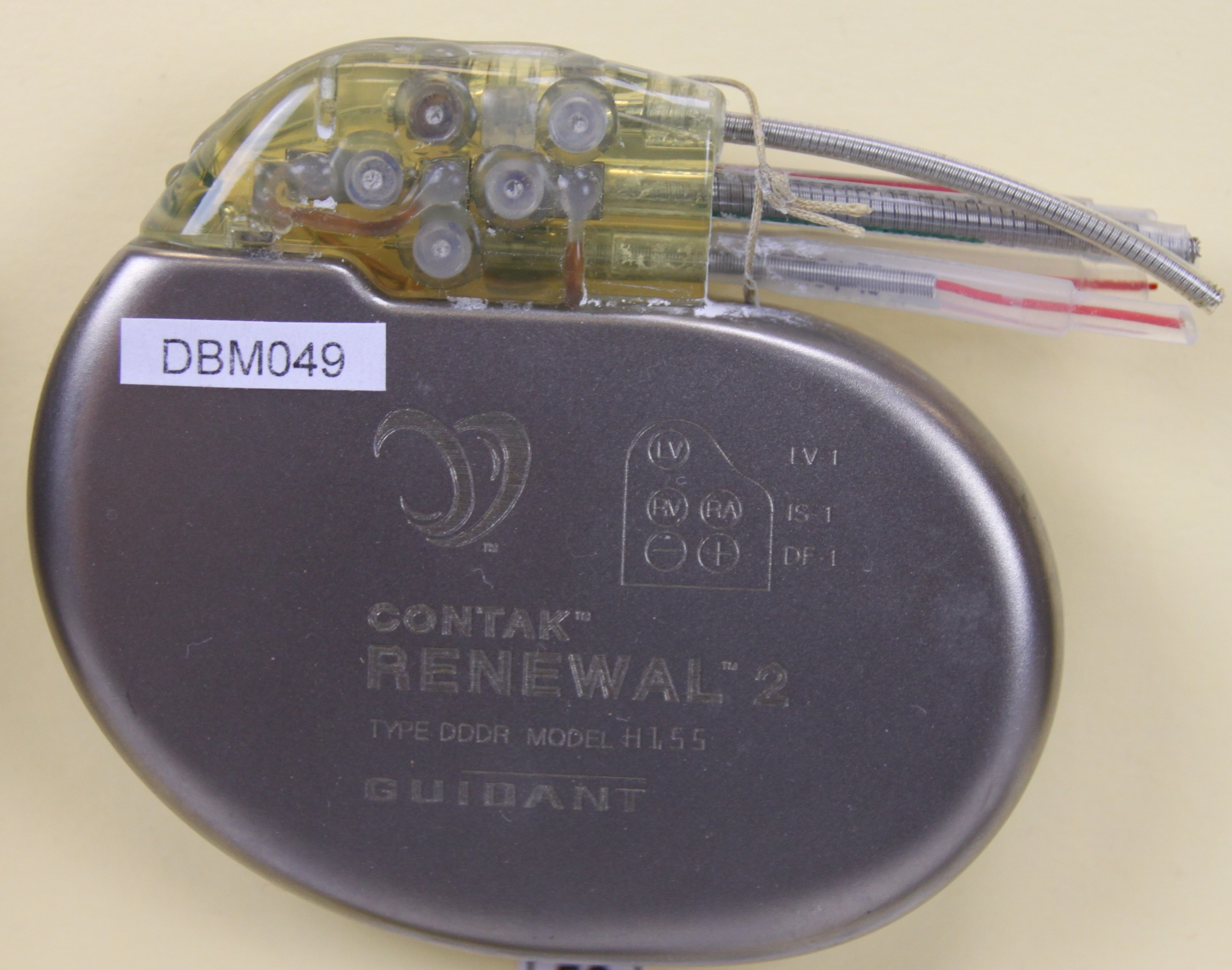 Herzschrittmacher-Defibrillator-Implantat Guidant Contak Renewal 2 (Krankenhausmuseum Bielefeld e.V. CC BY-NC-SA)