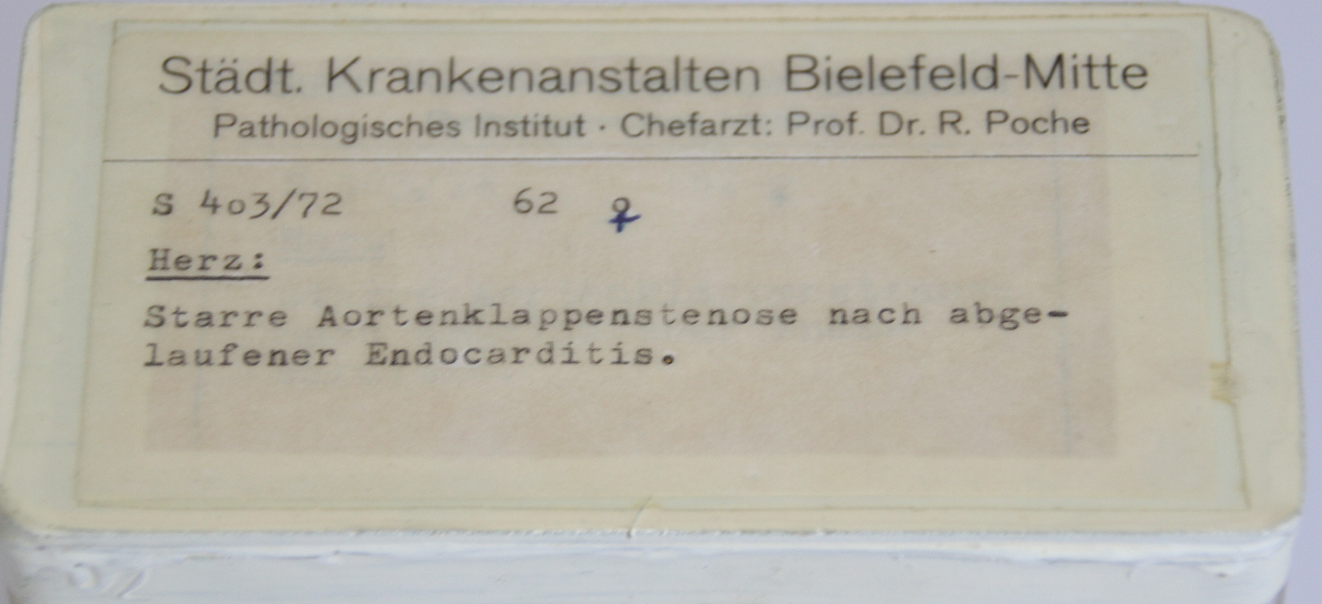 Herz-Präparat mit Aortenklappenstenose (Krankenhausmuseum Bielefeld e.V. CC BY-NC-SA)