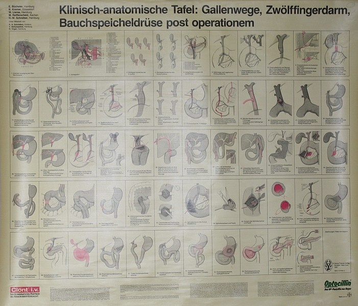 Lehrtafel Gallenwege postop. (Krankenhausmuseum Bielefeld e.V. CC BY-NC-SA)