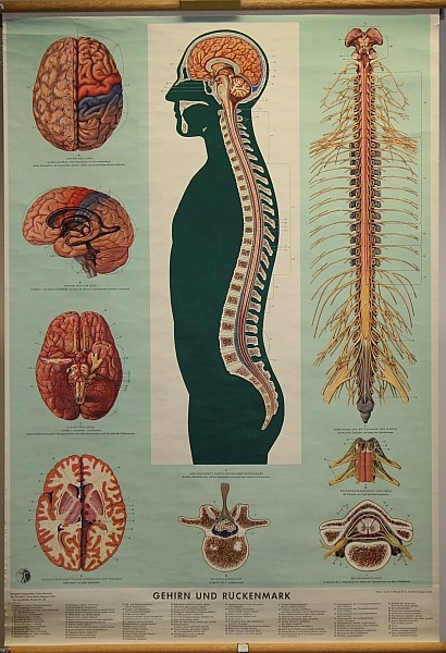 Lehrtafel Gehirn und Rückenmark (Krankenhausmuseum Bielefeld e.V. CC BY-NC-SA)