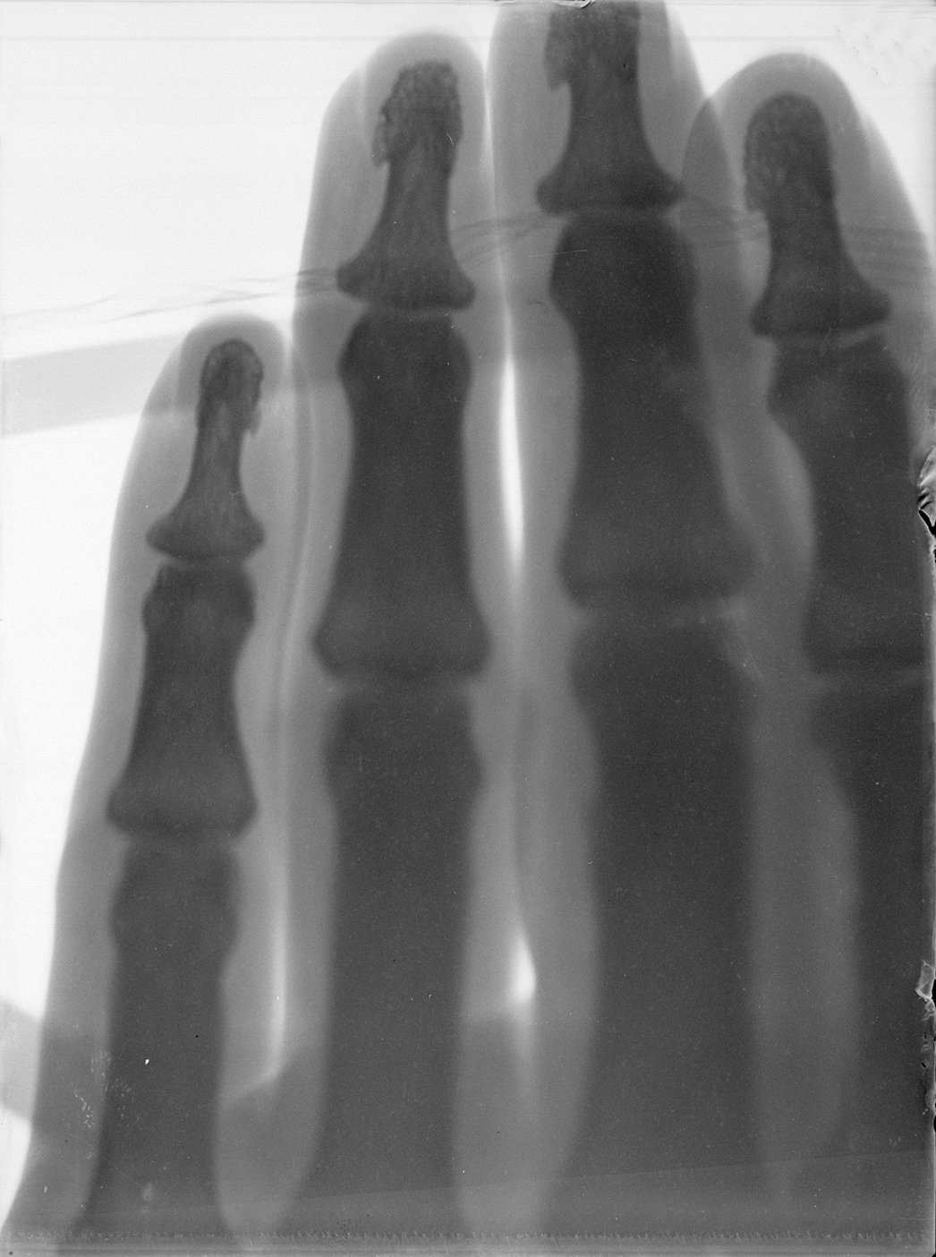 Versuch: Röntgenaufnahme einer Hand (21.05.1896), 86352_o (DRM CC BY-NC-SA)