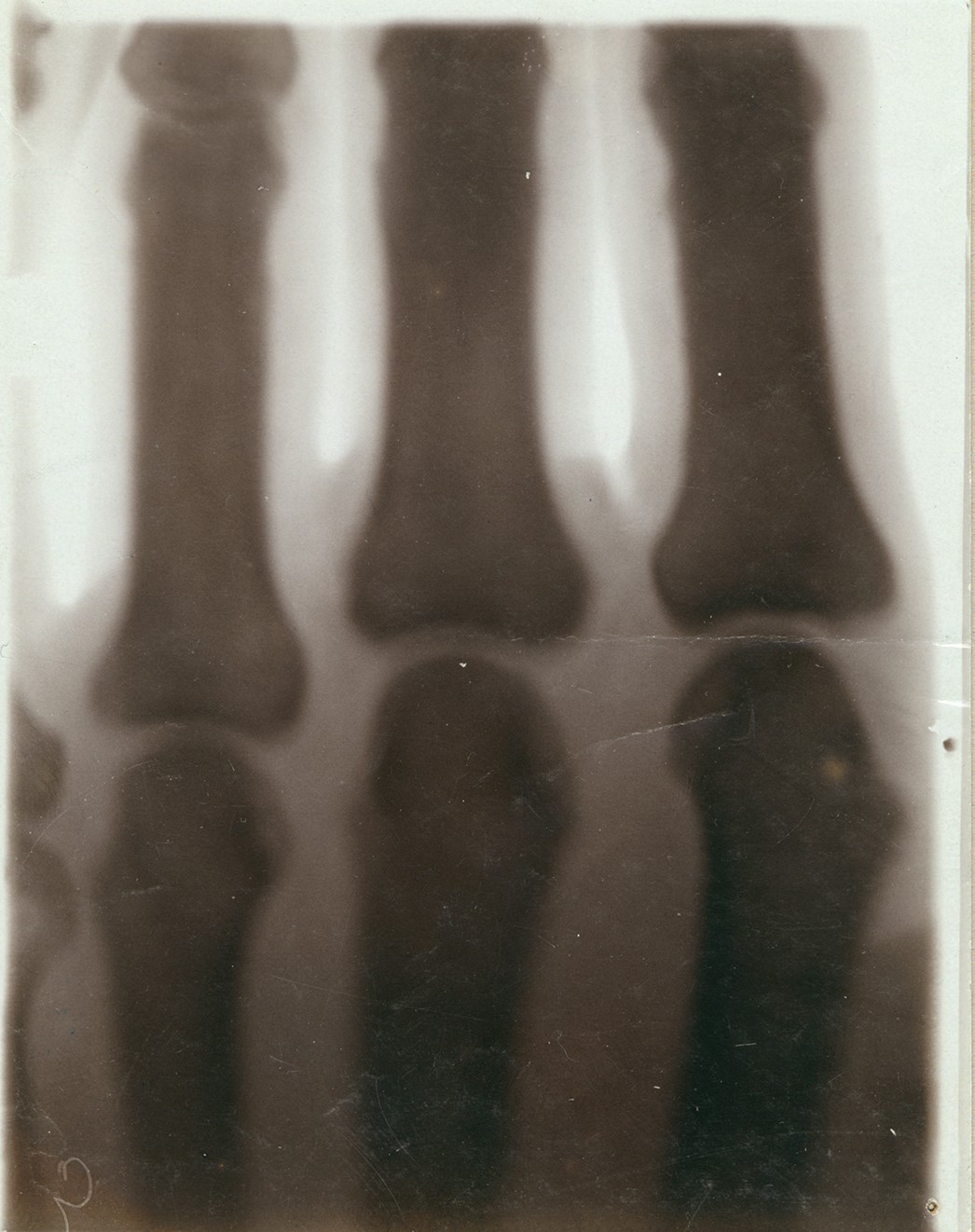Versuch: Röntgenaufnahme einer Hand (20.05.1896), 86355 p (Deutsches Röntgen-Museum CC BY-NC-SA)