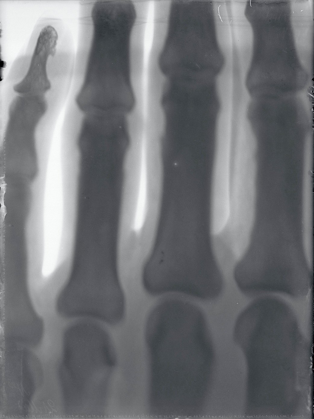Versuch: Röntgenaufnahme einer Hand (21.05.1896), 86356_o (DRM CC BY-NC-SA)