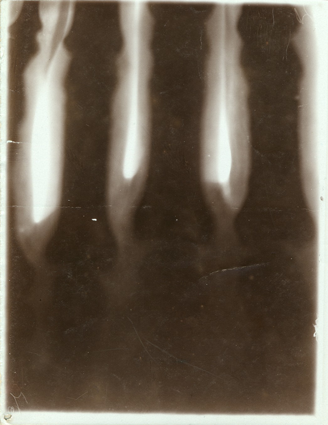Versuch: Röntgenaufnahme einer Hand (20.05.1896), 86357 p (Deutsches Röntgen-Museum CC BY-NC-SA)