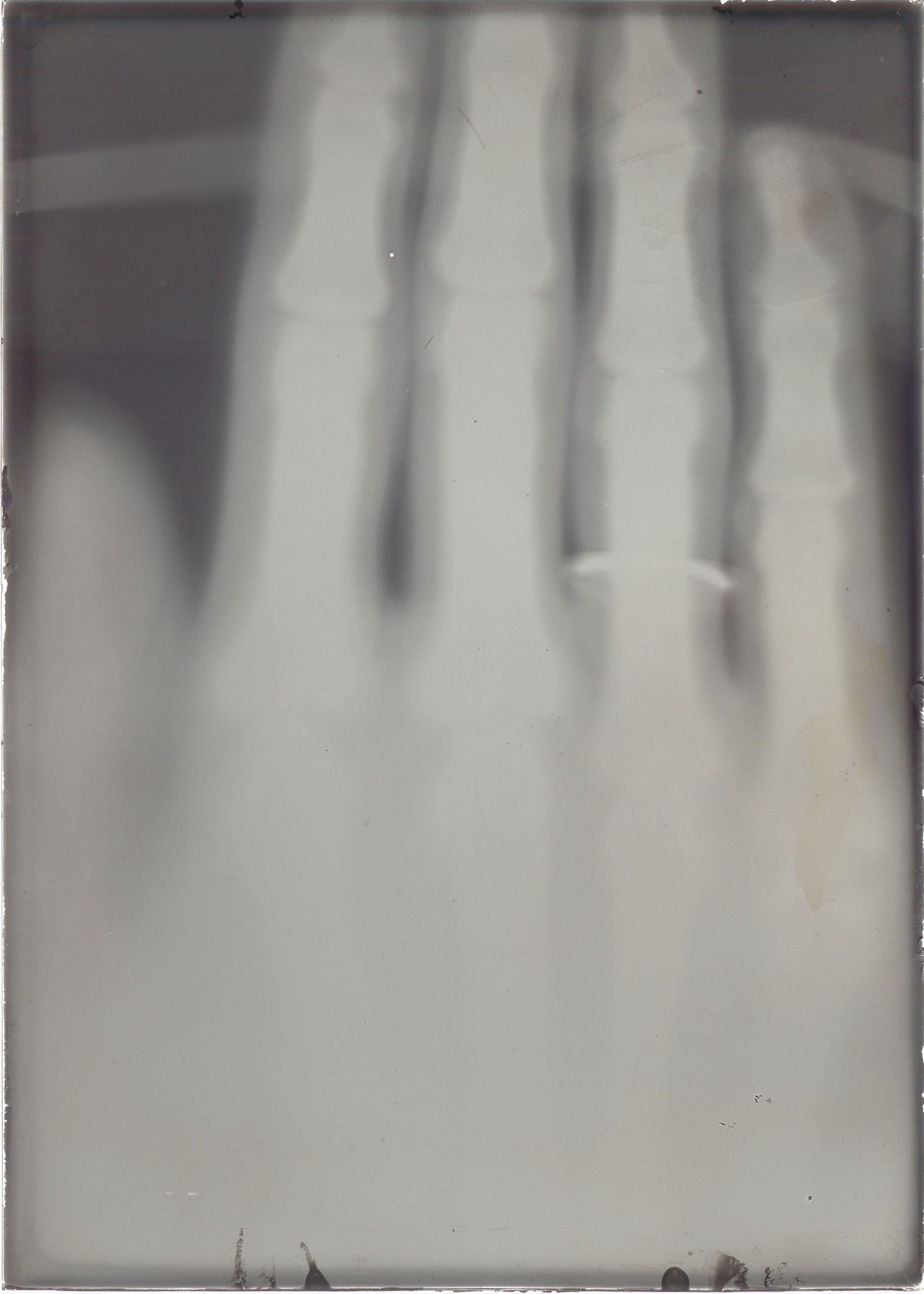 Versuch: Röntgenaufnahme einer Hand (November-Dezember 1895), 86728 gp (Deutsches Röntgen-Museum CC BY-NC-SA)
