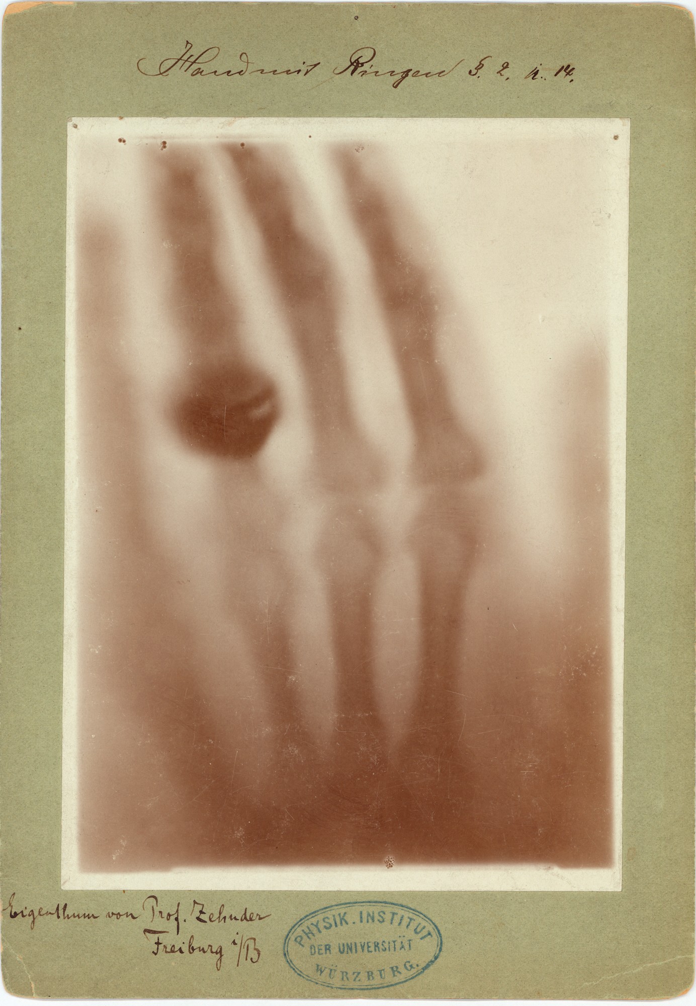 Versuch: Durchleuchtung einer menschlichen Hand (22.12.1895), 89008 p (Deutsches Röntgen-Museum CC BY-NC-SA)
