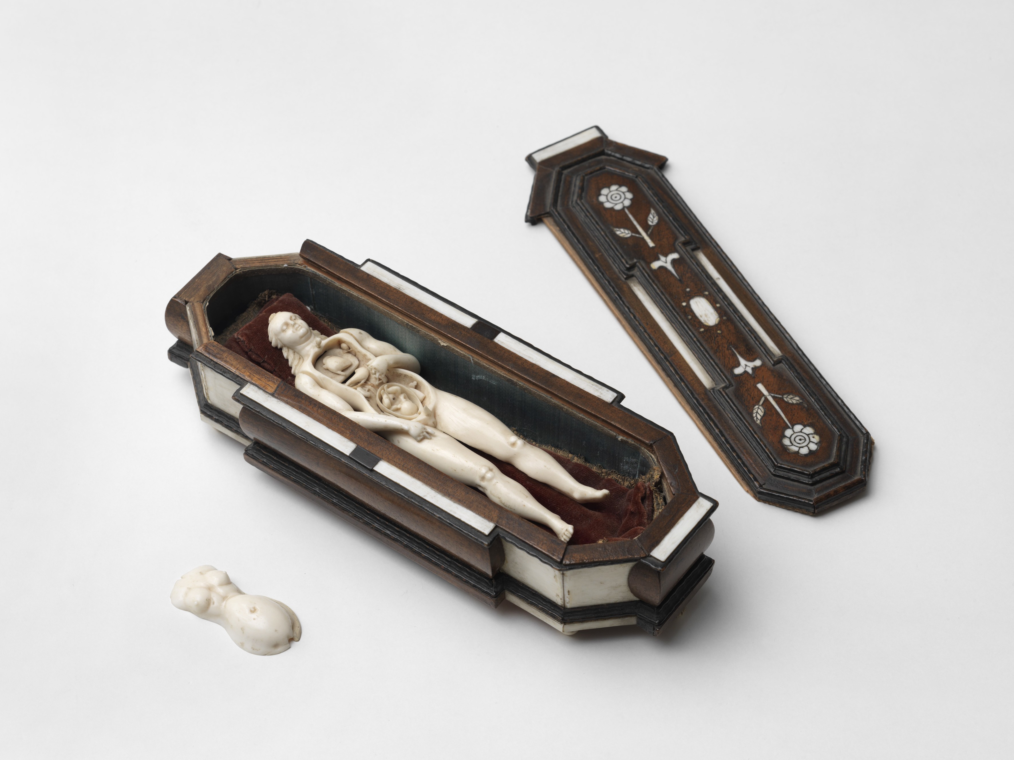 Anatomisches Modell einer schwangeren Frau, Nürnberg (Städtisches Museum Schloss Rheydt CC BY)