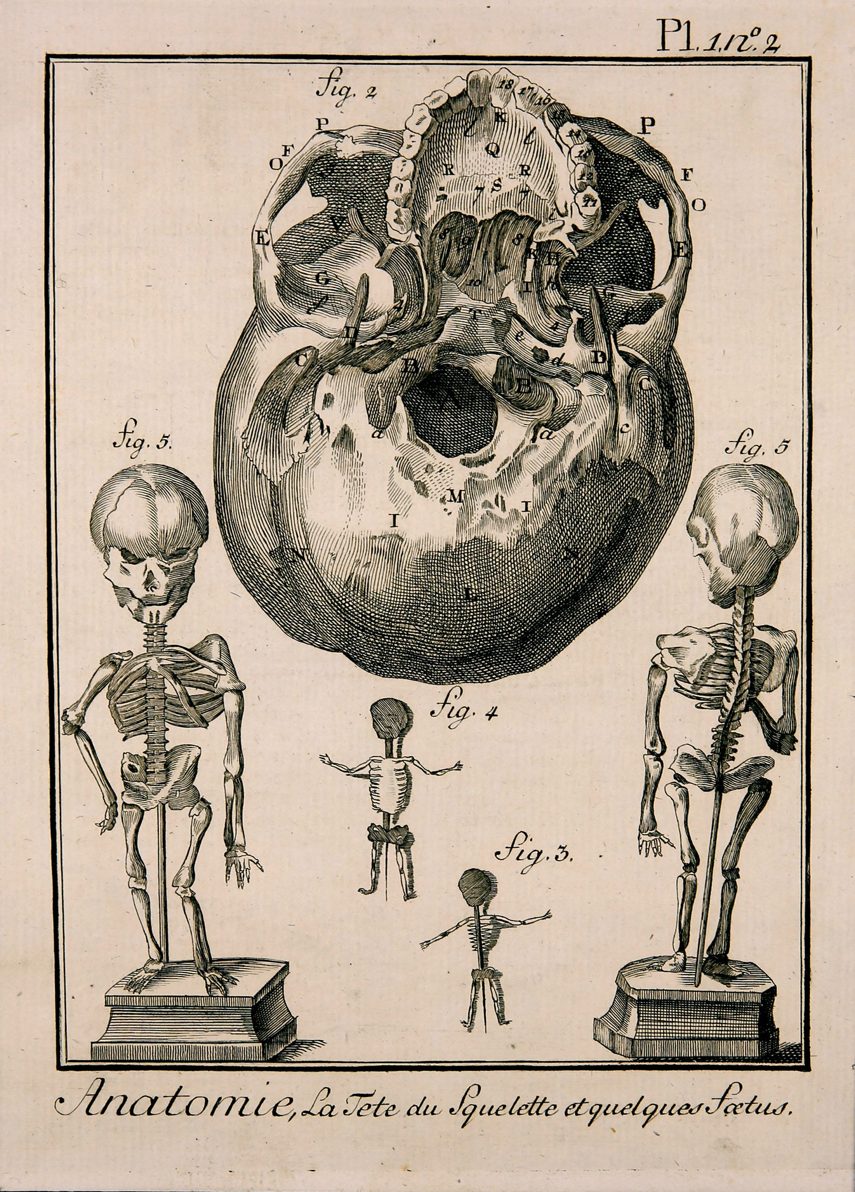 Anatomie, P1.1.Nr.2 (Wilhelm-Fabry-Museum CC BY-NC-SA)
